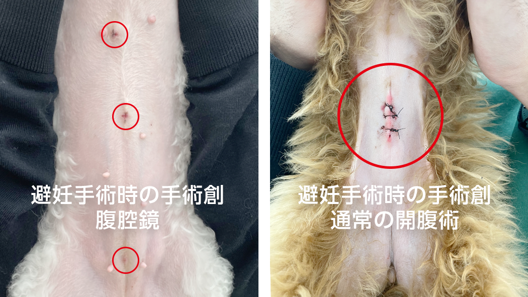 腹腔鏡器具のクローズアップやモニター画面の手元カット